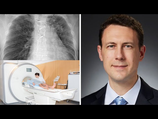 Sternum Wires & Heart Surgery: How Do Wires Work? Can I Get An MRI? What About Sternal Wire Removal?