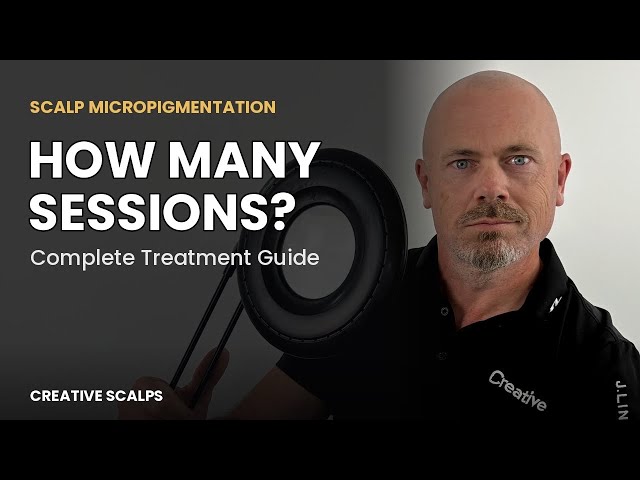 How Many SMP Sessions Do I Need ? | Treatment Guideline 