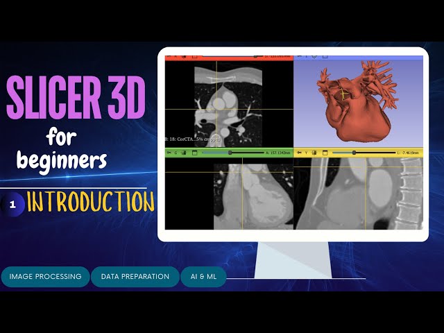Introduction to Slicer 3D | Tutorial for Dicom data handling