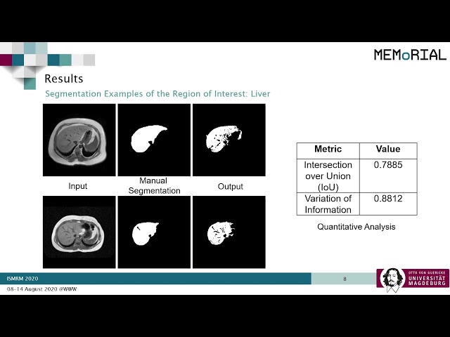 Unsupervised learning for Abdominal MRI Segmentation using 3D Attention W-Net