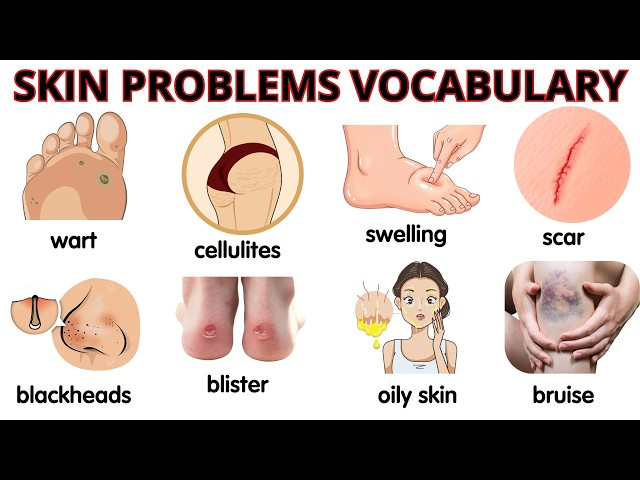 Skin Problems Vocabulary in English | Learn Common Skin Conditions with Meanings and Examples