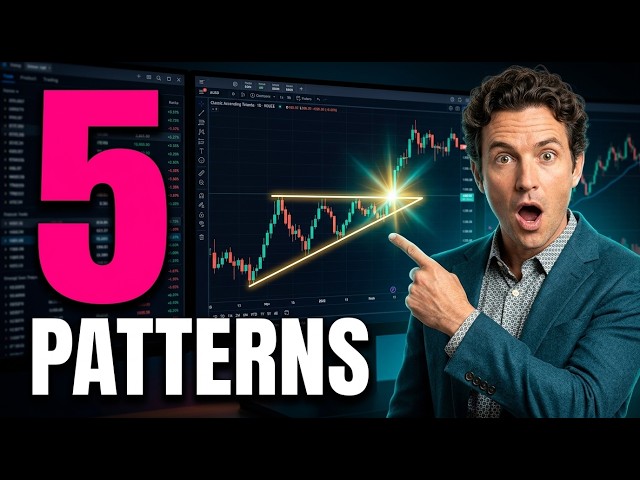 5 Chart Patterns Every Trader Needs to Recognize