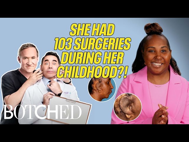 Rasheera Hears For The FIRST TIME After 103 Surgeries (Before & After) | Botched | E!