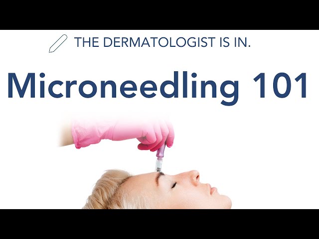 What is Microneedling and Which One is the BEST Type of Microneedling? | Dermapedia