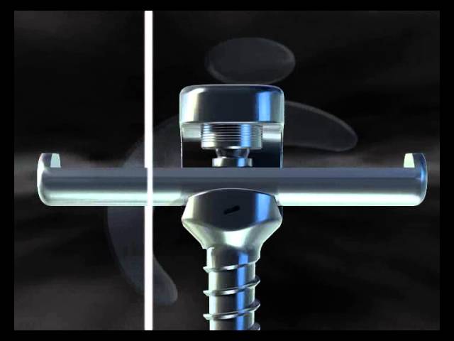 Easyspine Pedicle Screw System