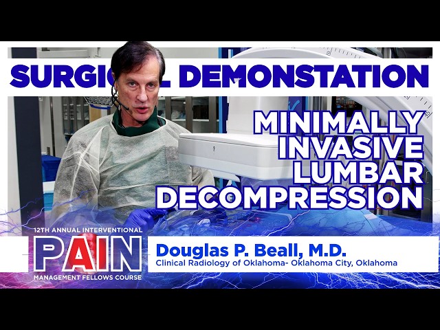 Minimally Invasive Lumbar Decompression - Doug Beall, M.D.