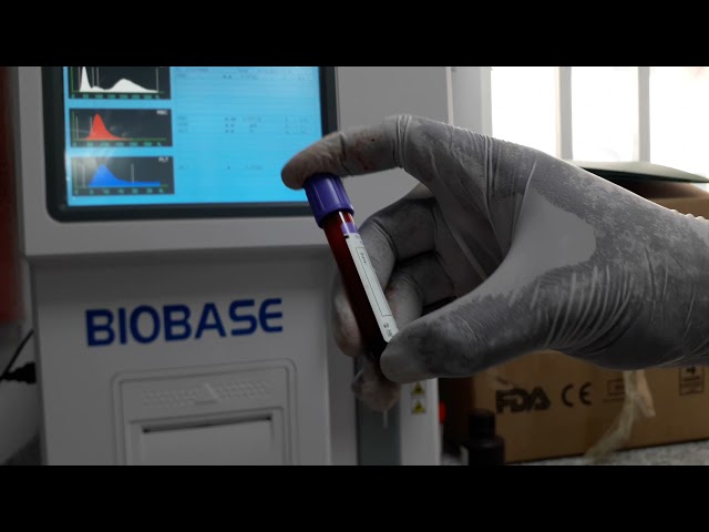 TESTING BLOOD SPECIMEN IN A BIOBASE AUTOANALYZER Procedure by Nelson