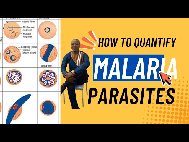 Quantifying Malaria parasites on thick and thin blood film explained! | Parasitology 