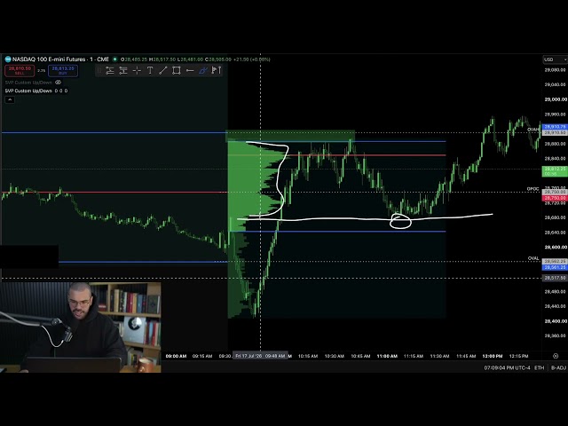 Here's Why Developing Volume Profile is the SECRET SAUCE (Day 4)