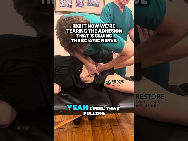 Fixing #sciatica #sciaticarelief #sciaticapain #sciaticatreatment