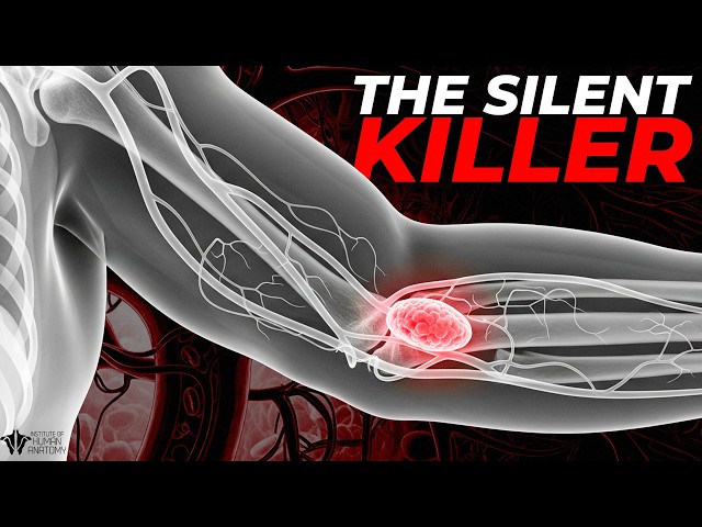 The Silent Warning Signs of Blood Clots