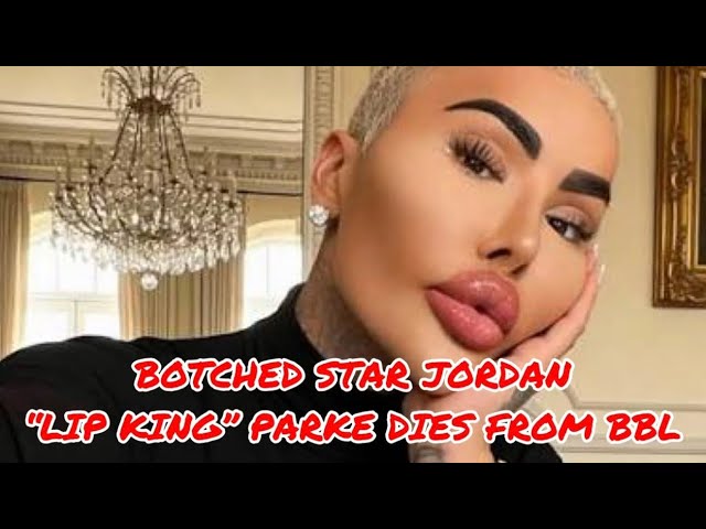 Botched BBL Death: What Went Wrong in the “Lip King” Case?