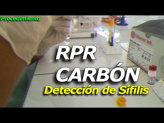 Complete Guide to Syphilis Detection with Charcoal RPR: Understanding the Step-by-Step Procedure