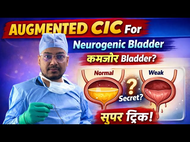 Augmented CIC || How is CIC done || Weakness of urinary bladder || Neurogenic bladder