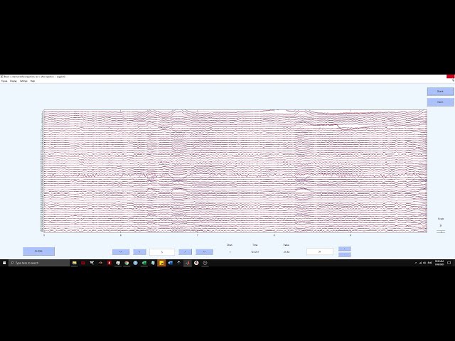 Pre-Processing EEG data using EEGLAB GUI