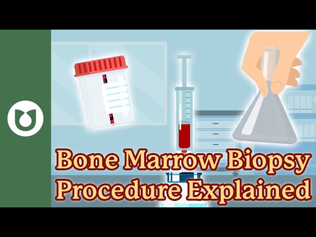 What to Expect During a Bone Marrow Biopsy: Step-by-Step Guide for Blood Cancer Patients