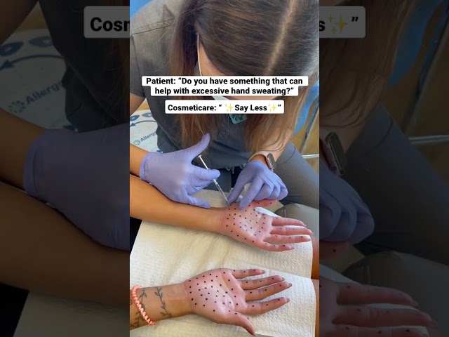 Botox for your hands?? #shorts #botox #sweat