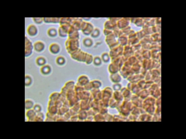 Trypanosomes in three different fresh blood preparations