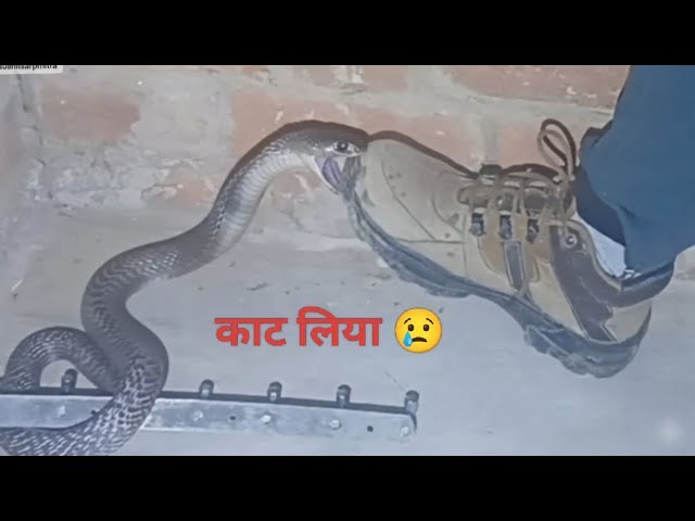 कोबरा सांप ने काट लिया 😢 पैर में 😱 @sushilsarpmitra 