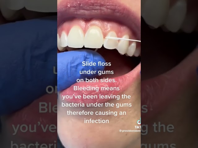 Are you flossing properly? #dentaltips #dentaleducation
