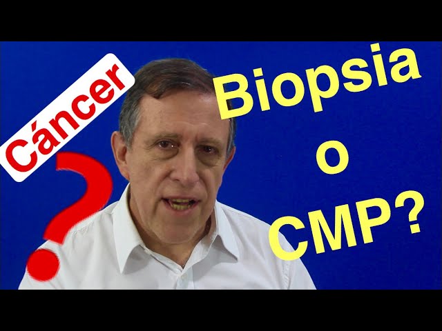 Prostate cancer: Biopsy or CMP