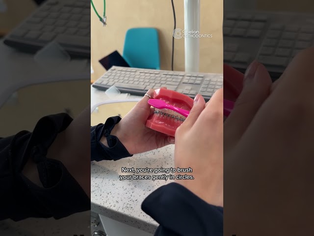 How to brush your teeth with braces