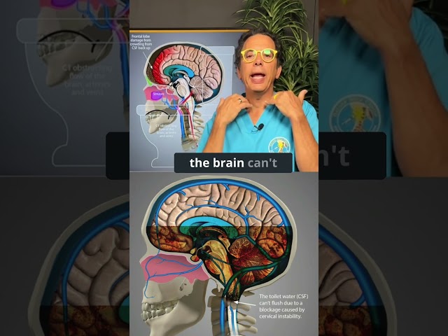 Brain fog and toxin buildup coming from the neck #brainfog #toxic #dementiaprevention #toilet