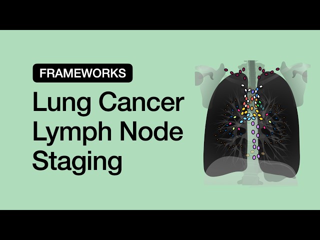 Lung Cancer Lymph Node Staging: The Radiologist's Cheat Sheet