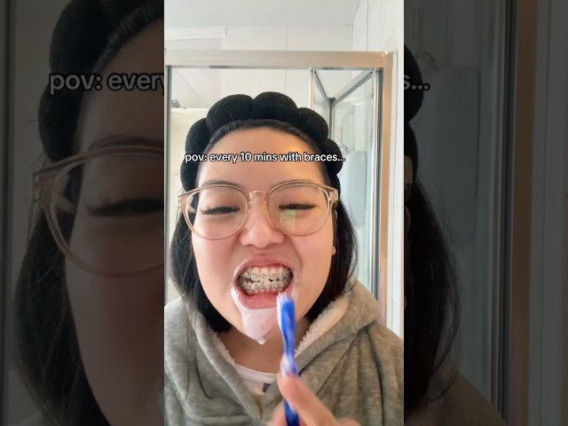 Are You Brushing Properly with Braces?