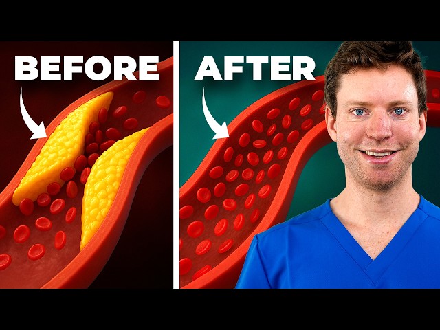 Ezetimibe is Ridiculously Underrated for Heart Disease