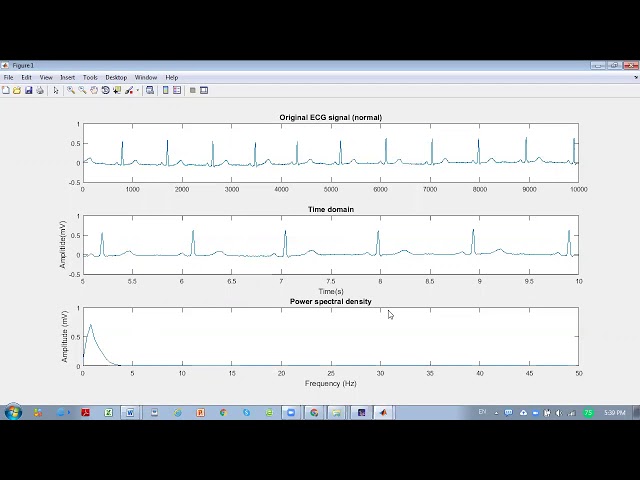 Signal Processing Matlab - How to import raw ECG data from Physionet database