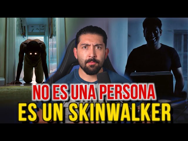 HER HUSBAND IS A SKINWALKER