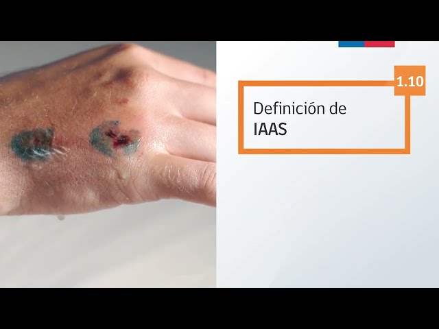 1.10 Definición de las IAAS