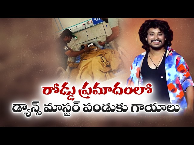 Dance Master Pandu Injured in Road Accident at Vizag