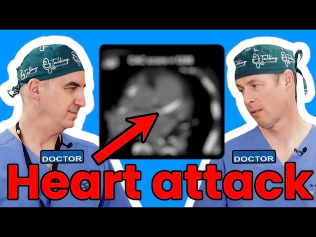 Coronary Artery Calcium Score (CAC) - Can It Predict A Heart Attack?