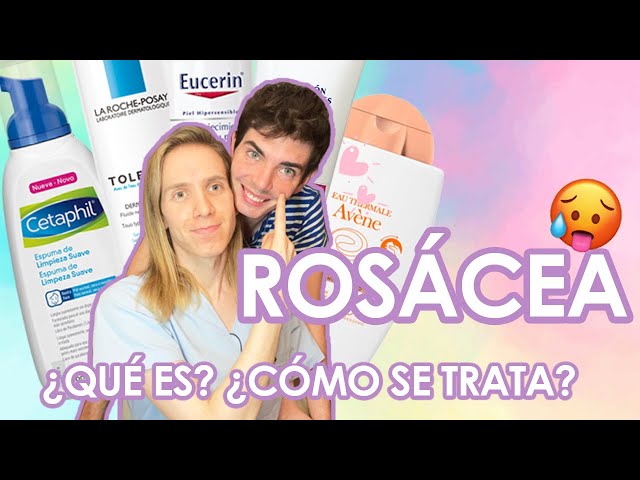 What is ROSACEA? How is it treated? + Products I recommend