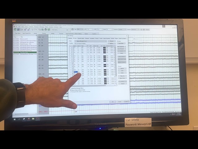 Creating, copying and editing a montage on the Natus.