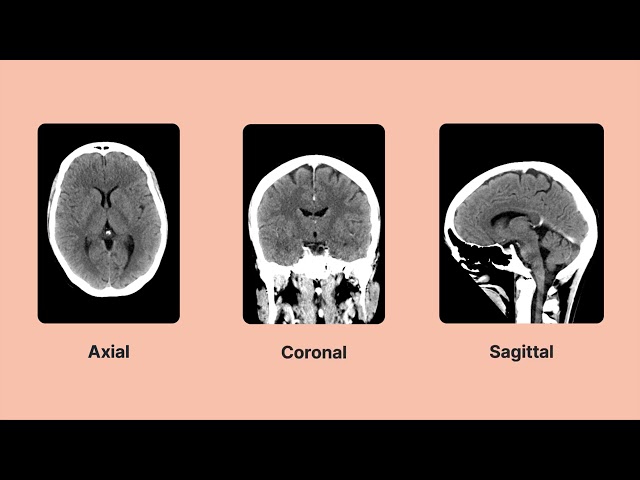 How does computed tomography (CT) work, and what is it used for?: Overview of CT imaging