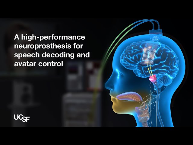 A Neuroprosthesis for Speech Decoding and Avatar Control | Chang Lab - UCSF