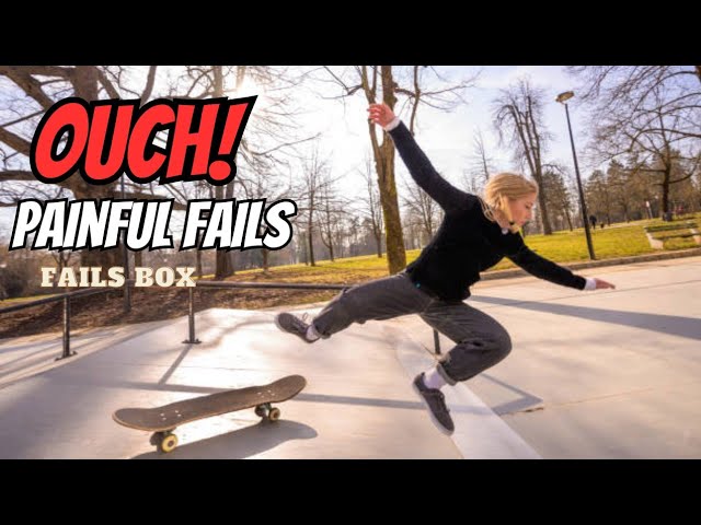 Broken Bones & PAINFUL FAILS : Fails Of The Week
