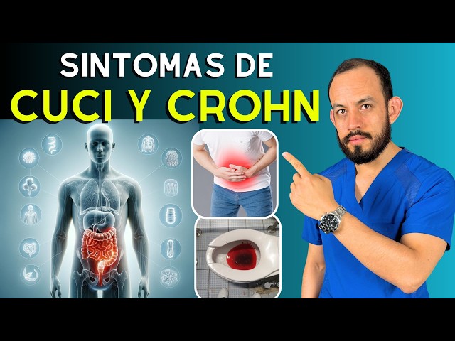 🦴 Crohn’s Disease and Ulcerative Colitis (UC) Symptoms