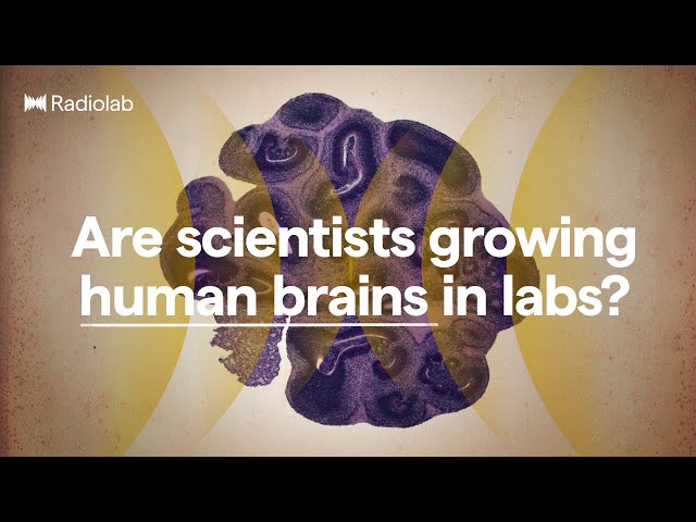 Brain Balls | Radiolab Podcast
