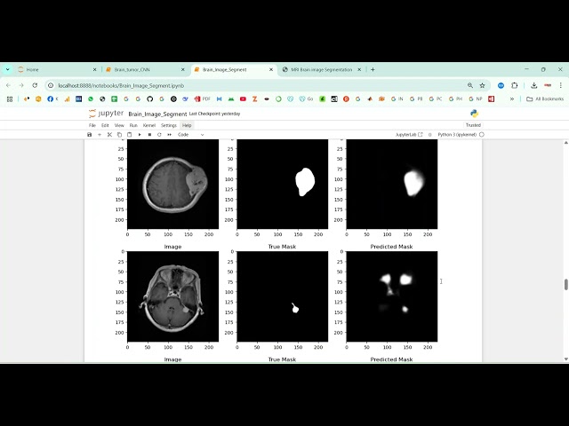 MRI Brain  Image Segmentation using CNN in Python Projects