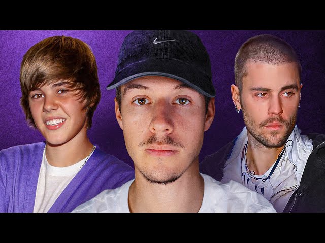 JUSTIN BIEBER: Famous too young?