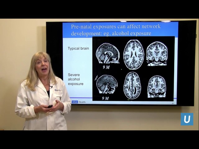 How Does a Child's Brain Develop? | Susan Y. Bookheimer PhD | UCLAMDChat