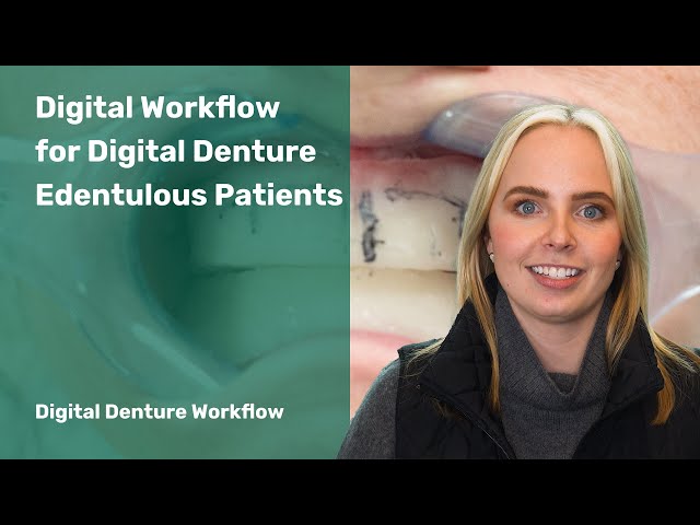Digital Denture Workflow: Digital Workflow For Digital Denture Edentulous Patients