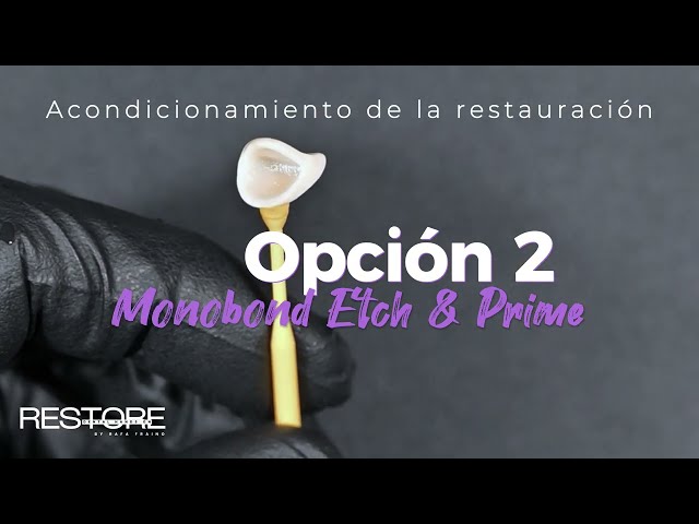 e.max: Cementación Adhesiva 2 protocolos de acondicionamiento | Disilicato de Litio #e.max #ivoclar