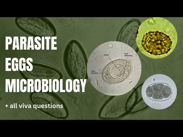 Parasite eggs .microbiology spotting.spotters and viva questions microbiology