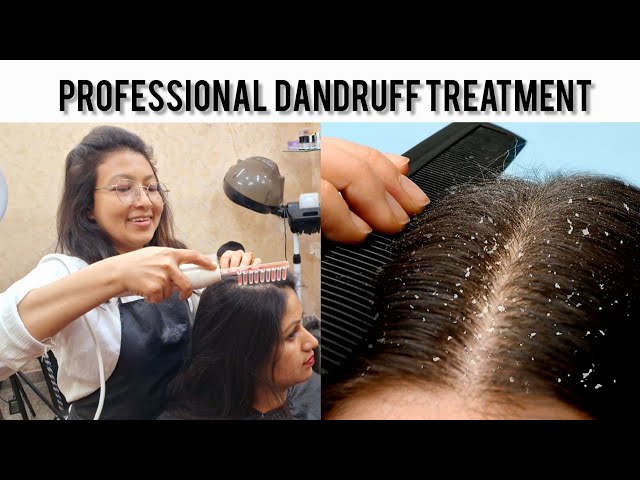 High frequency Dandruff treatment || professional use Step By Step!!