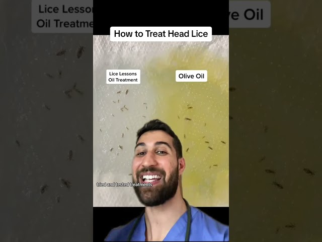 How to Treat Head Lice #parasites Treating head lice requires a combination of methods such as using